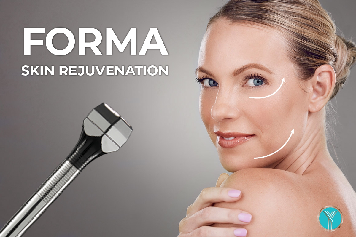 FORMA skin rejeuvenation