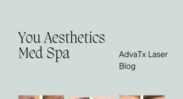 AdvaTx Skin Rejuvenation Laser Treatments  •  <a href='https://youbeautylounge.com/articles/advatx-skin-rejuvenation-laser-treatments'>Click Here →</a>